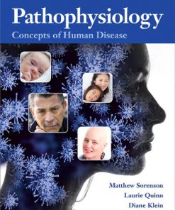 Test Bank for Pathophysiology: Concepts of Human Disease, 1st Edition, Matthew Sorenson, Lauretta Quinn, Diane Klein